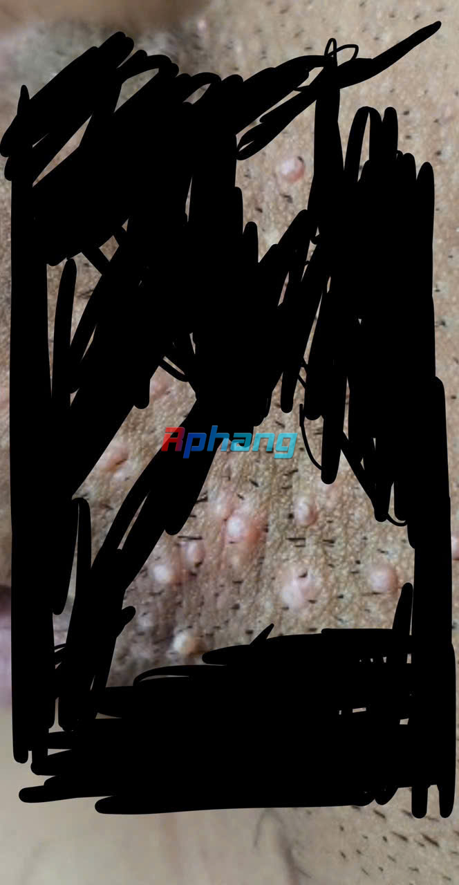 z5844873039560_023cb02a928b755a77ae8a892f37097b.jpg