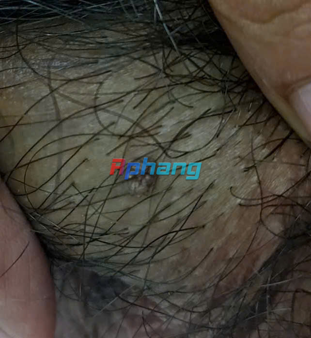 z5844873046791_c4855918a71615efed471633d9ce9e63.jpg