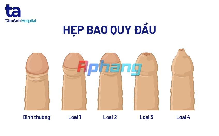 hep-bao-quy-dau.jpg