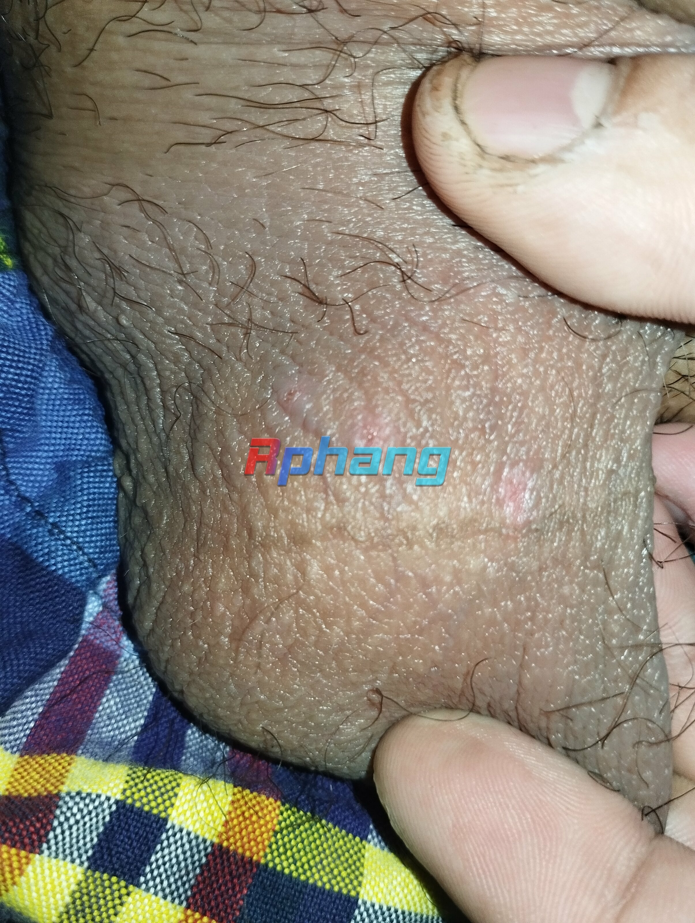 1000038075.jpg