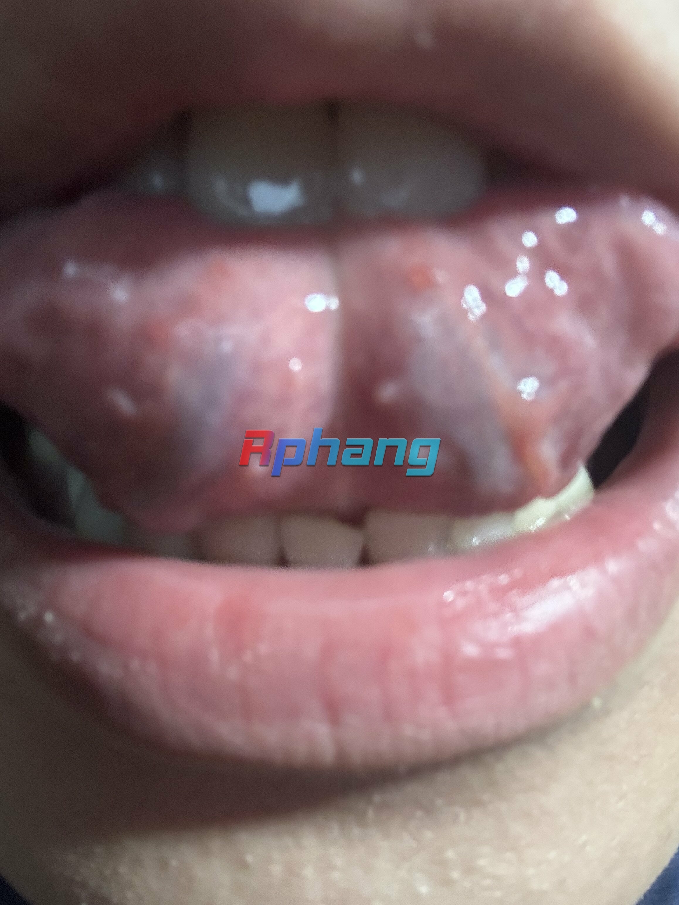 IMG_5761.jpeg