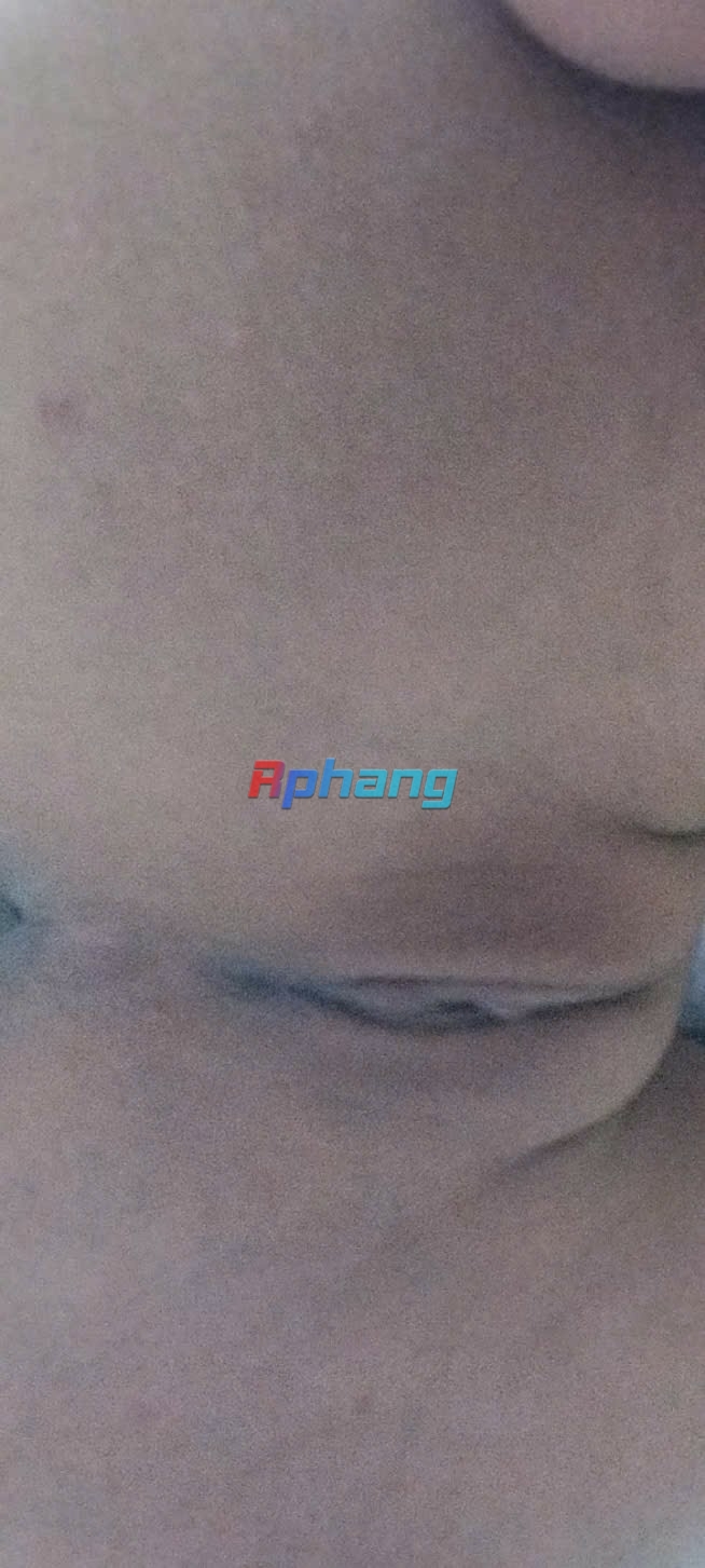 1000036278.jpg